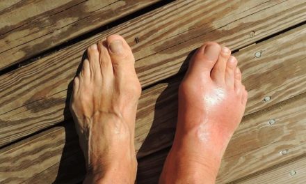 5 Buah Ampuh Turunkan Asam Urat Tinggi Secara Alami