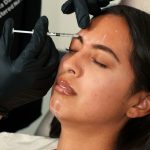 Overfilled Syndrome Akibat Filler Berlebihan, Wajah Bisa Kehilangan Proporsi Alami